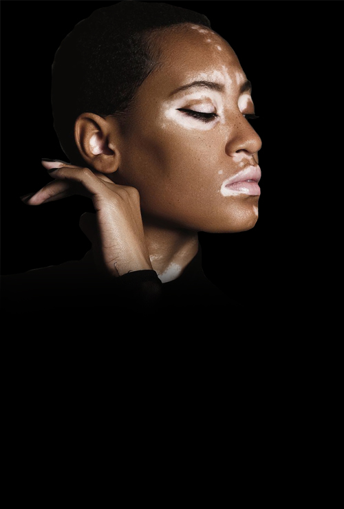 MicroSkin campaign